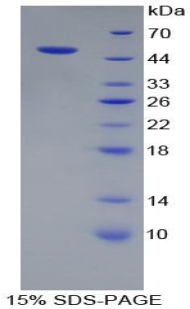 Recombinant Proteasome 26S Subunit, ATPase 3 (PSMC3)