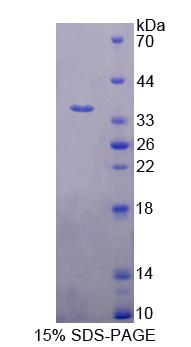 Recombinant Proteasome Activator Subunit 3 (PSME3)