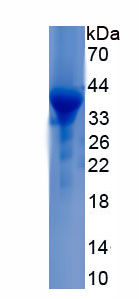 Recombinant Keratinocyte Differentiation Associated Protein (KRTDAP)