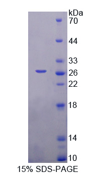 Recombinant Nephroblastoma Overexpressed Gene (NOV)