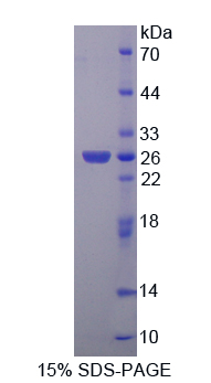 Recombinant Nephroblastoma Overexpressed Gene (NOV)