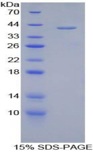 Recombinant Corin (CRN)