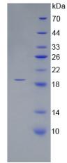 Recombinant Corin (CRN)