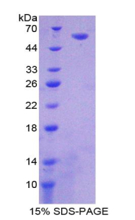 Recombinant Corin (CRN)