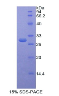 Recombinant Selenium Binding Protein 1 (SELENBP1)