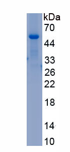 Recombinant Tryptophan Hydroxylase 1 (TPH1)