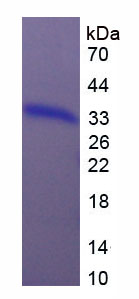 Recombinant B-Raf Proto Oncogene Serine/Threonine Protein Kinase (BRAF)