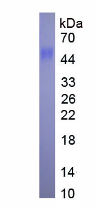 Recombinant Cholesterol-25-Hydroxylase (CH25H)