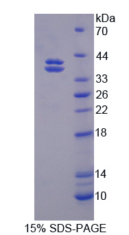 Recombinant Cadherin EGF LAG Seven Pass G-Type Receptor 2 (CELSR2)