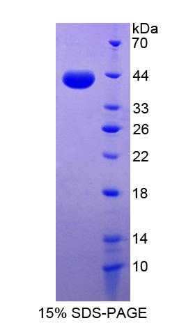 Recombinant Desmocollin 2 (DSC2)