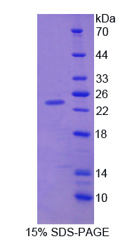 Recombinant Cerebral Dopamine Neurotrophic Factor (CDNF)