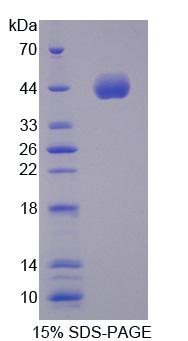 Recombinant 5-Methyltetrahydrofolate Homocysteine Methyltransferase (MTR)