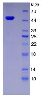 Recombinant Betaine Homocysteine Methyltransferase 2 (BHMT2)