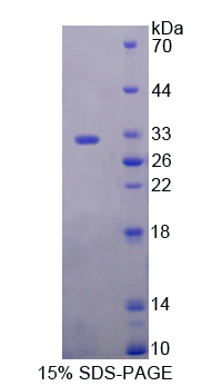 Recombinant Glycine Dehydrogenase (GLDC)