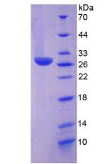 Recombinant Histidine Decarboxylase (HDC)