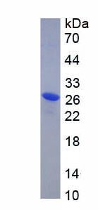 Recombinant Phosphopantothenoylcysteine Decarboxylase (PPCDC)