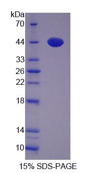 Recombinant Uroporphyrinogen Decarboxylase (UROD)