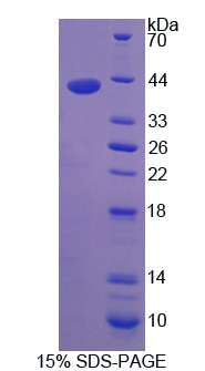 Recombinant Farnesyltransferase Alpha (FNTa)