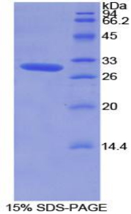 Recombinant Receptor Tyrosine Kinase Like Orphan Receptor 1 (ROR1)