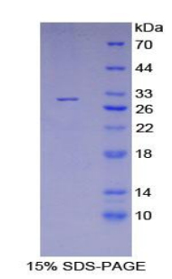 Recombinant V-Yes-1 Yamaguchi Sarcoma Viral Related Oncogene Homolog (LYN)