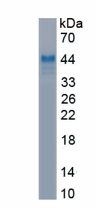 Recombinant Triggering Receptor Expressed On Myeloid Cells 2 (TREM2)