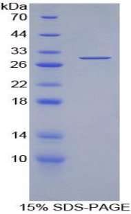 Recombinant Torsin 3A (TOR3A)