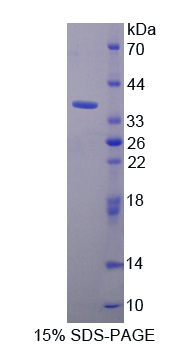 Recombinant Torsin 1A (TOR1A)