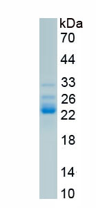 Recombinant Lens Epithelium Derived Growth Factor (LEDGF)