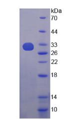 Recombinant TNF Receptor Associated Factor 2 (TRAF2)