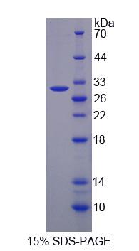 Recombinant Breast Cancer Anti-Estrogen Resistance 1 (BCAR1)