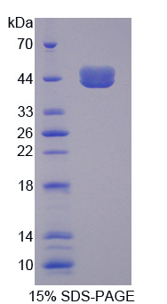 Recombinant Transcobalamin I (TCN1)