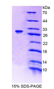 Recombinant Polyamine Oxidase (PAOX)