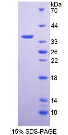 Recombinant Glycine-N-Methyltransferase (GNMT)