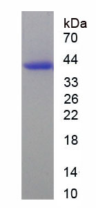 Recombinant WNK Lysine Deficient Protein Kinase 1 (WNK1)