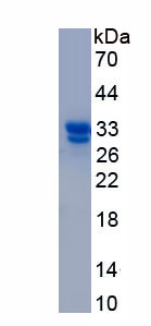 Recombinant Ubiquitin Carboxyl Terminal Hydrolase L1 (UCHL1)