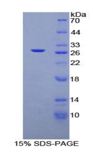 Recombinant Transforming Growth Factor Beta 1 Induced Transcript 1 (TGFb1I1)