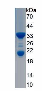 Recombinant Synaptonemal Complex Protein 3 (SYCP3)