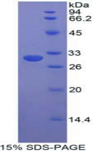 Recombinant STAM Binding Protein (STAMBP)