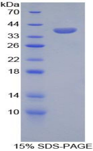 Recombinant Serine Peptidase Inhibitor Kazal Type 1 (SPINK1)