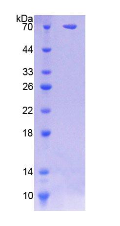 Recombinant N-Sulfoglucosamine Sulfohydrolase (SGSH)