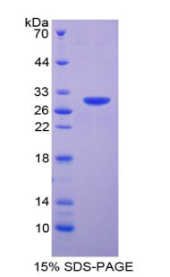 Recombinant Renal Tumor Antigen (RAGE)