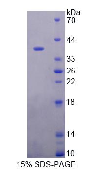 Recombinant Pituitary Tumor Transforming 1 Interacting Protein (PTTG1IP)