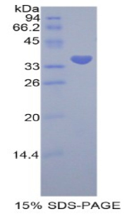 Recombinant Preferentially Expressed Antigen In Melanoma (PRAME)