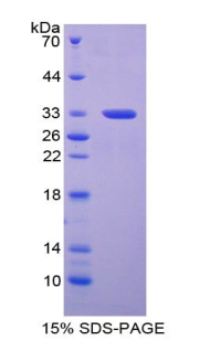 Recombinant Periplakin (PPL)