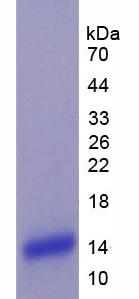 Recombinant Plexin B1 (PLXNB1)