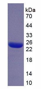 Recombinant Plastin 3 (PLS3)