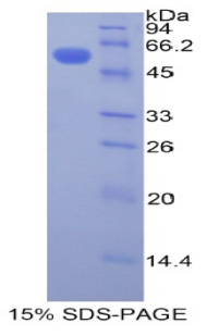 Recombinant Plastin 3 (PLS3)