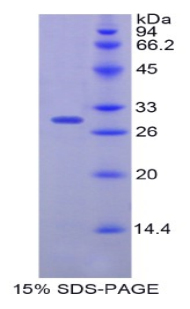 Recombinant Plastin 3 (PLS3)