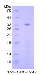 Recombinant Nucleoredoxin (NXN)