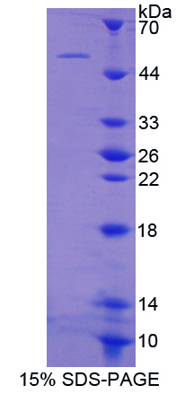 Recombinant Nexilin (NEXN)